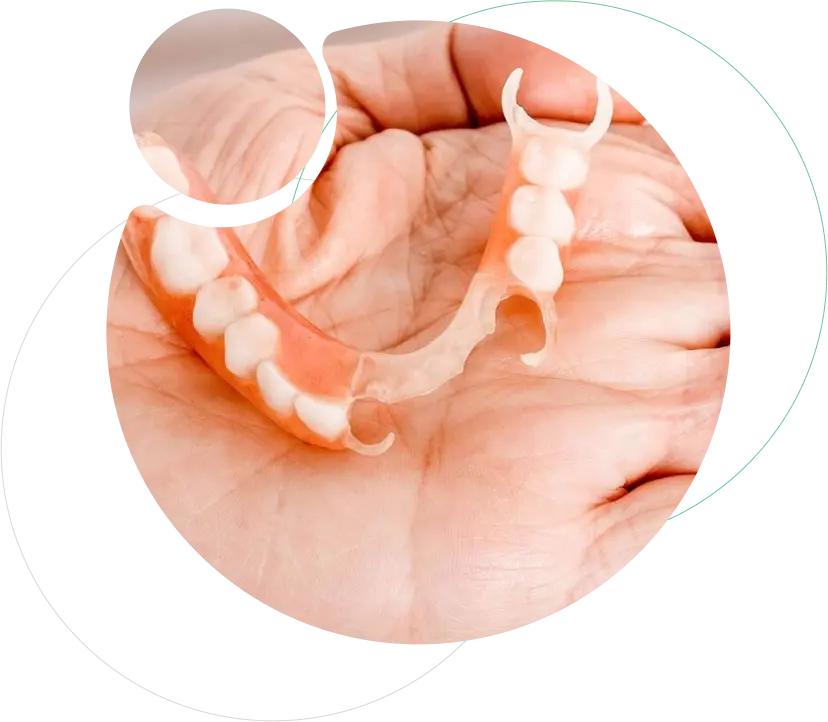 Flexible Dentures