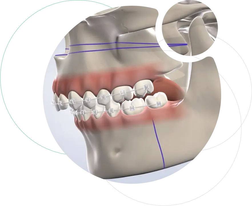 Maxillofacial Surgery