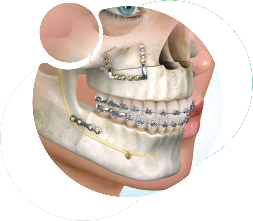 Maxillofacial Surgery