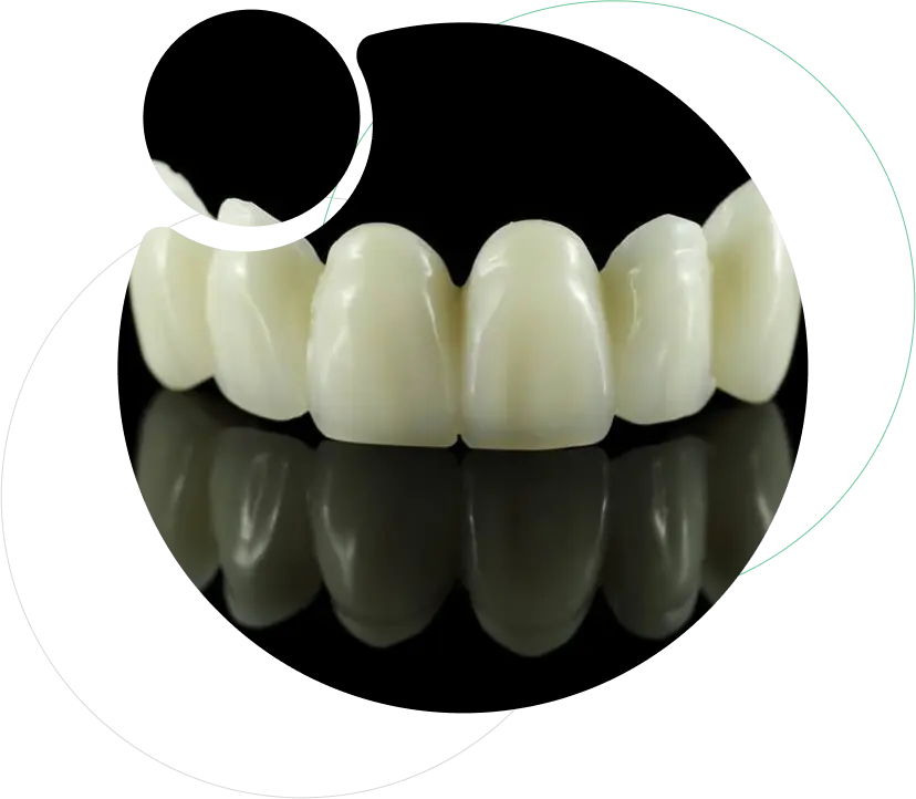 Zirconia Crowns and Bridges