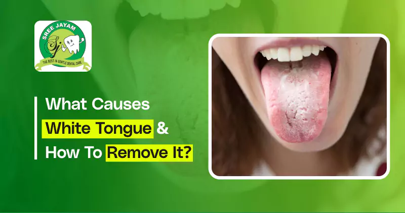 What Causes White Tongue & How to Remove It?
