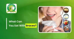 what can you eat with braces
