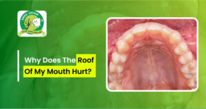 why does the roof of mouth hurt