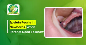 Epstein Pearls in Newborns